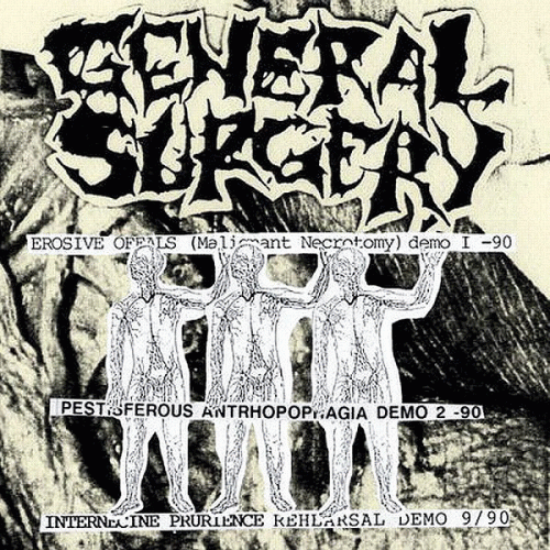 General Surgery : Demos